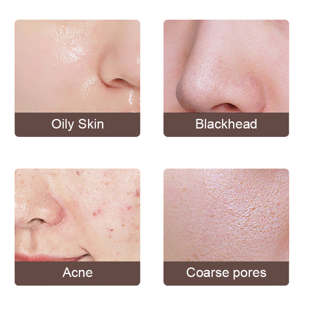 Ultrasonic Skin Scrubber – Deep Pore Facial Cleanser